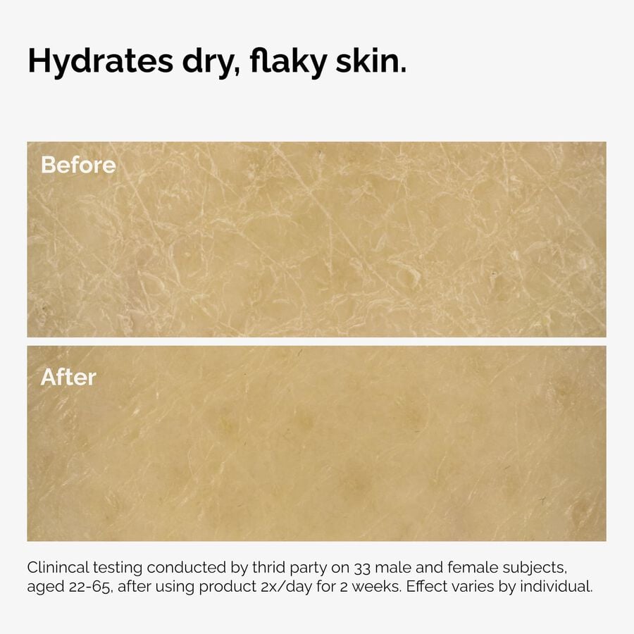 the-body-care-collection-x4 ord-natural-moisturizing-factors-inulin-body-before-after-graphic-02.jpg