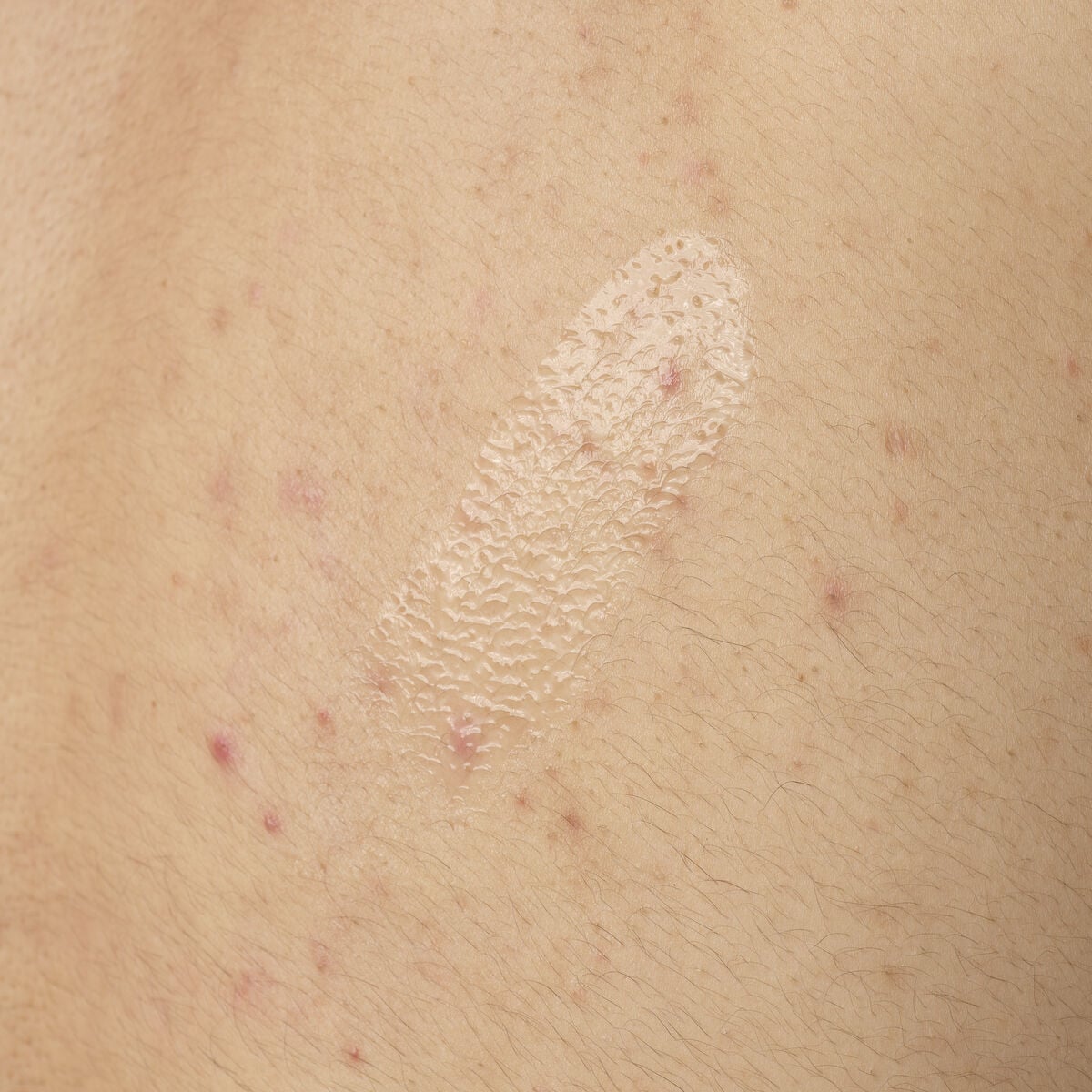 salicylic-acid-0-5-body-serum-t3 ORD-salicylic-acid-05-body-240ml-application.jpg