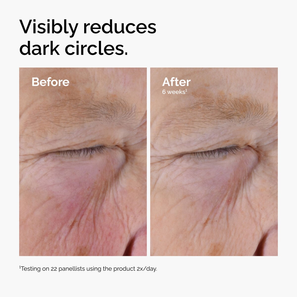 caffeine-solution-5-egcg-eye-serum-t6 ord-caffeine-solution-egcg-dark-circles-before-after.jpg