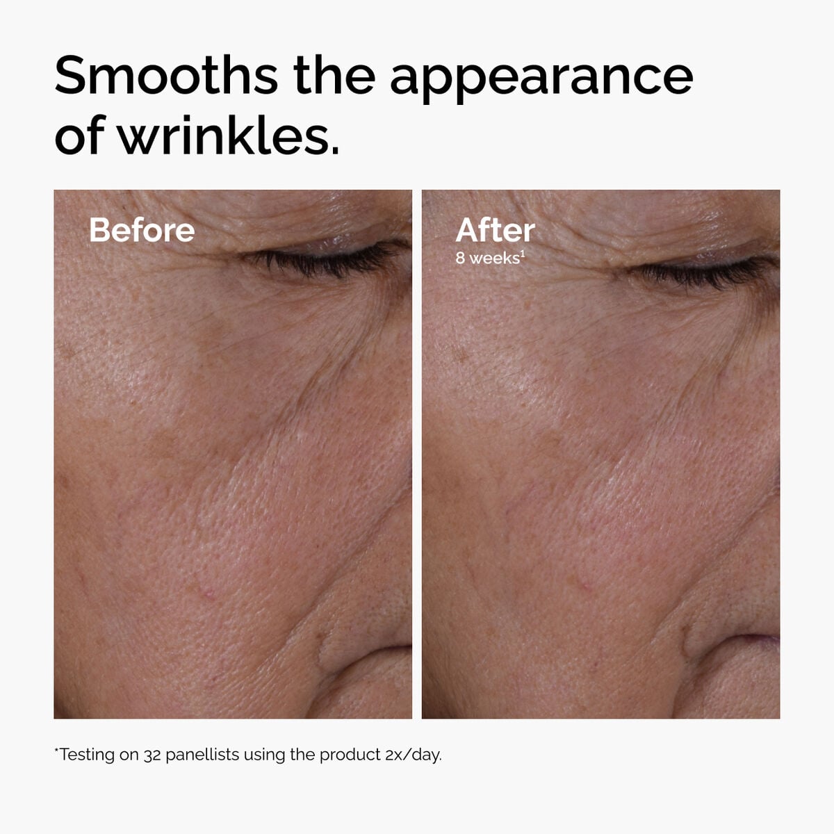 multi-peptide-ha-serum-o0 ord-multi-peptide-ha-serum-wrinkles-before-after.jpg