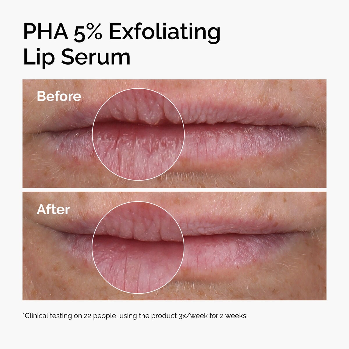 pha-5-exfoliating-lip-serum-p2 ord-pha-5pct-lip-exfoliating-serum-before-after.jpg