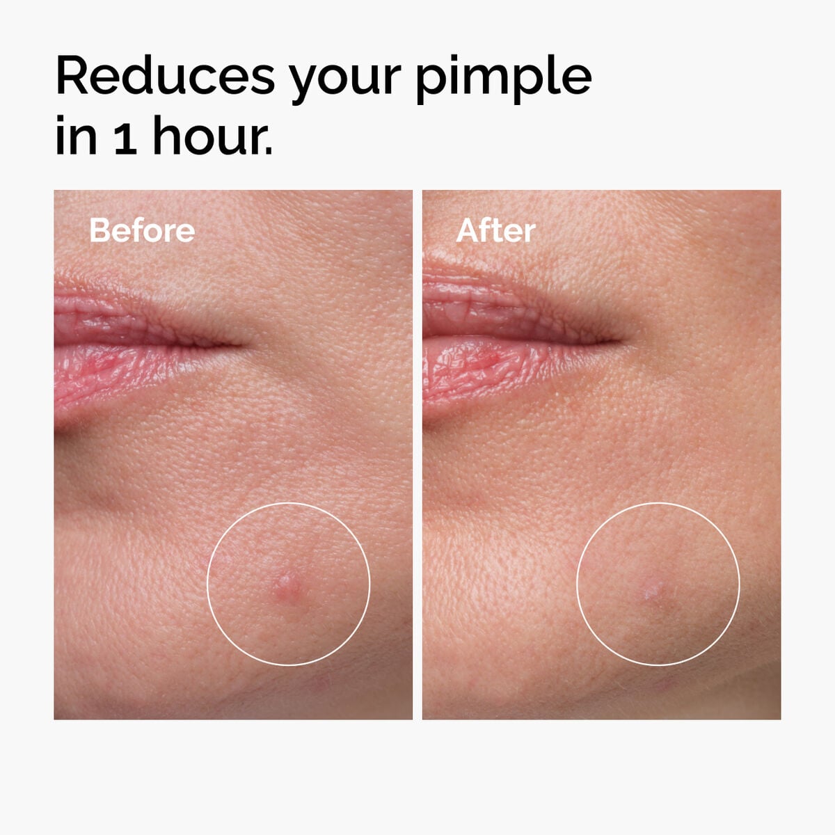 sulfur-10-powder-to-cream-concentrate-t0 ord-sulfur-10pct-powder-to-cream-concentrate-before-after-NA.jpg